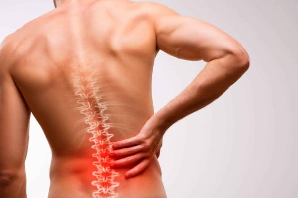 hernia-de-disco-1000x563